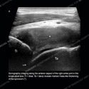 Ultrasound case 175 thumbnail