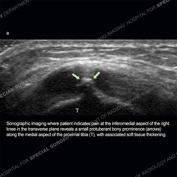 Diagnosis Case 207