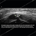 Ultrasound case 176 thumbnail