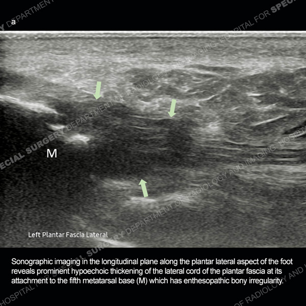 Ultrasound Case 178