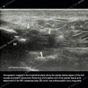 Ultrasound case 178 thumbnail