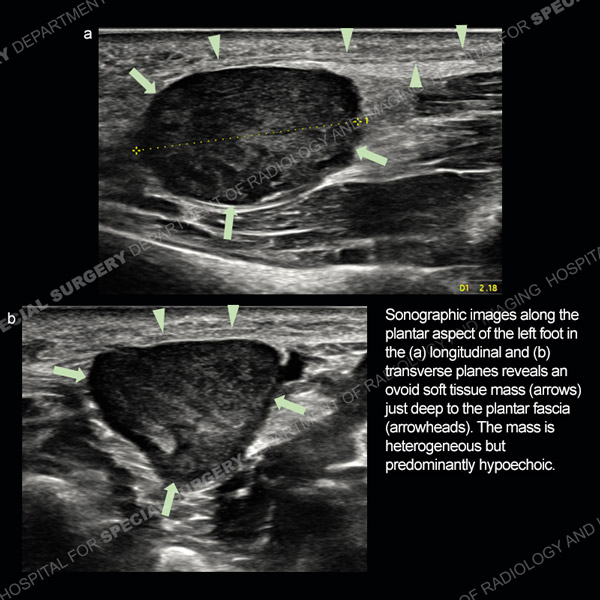 Ultrasound Case 180