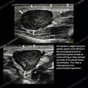 Ultrasound case 180 thumbnail
