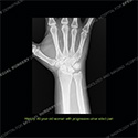what's the diagnosis thumbnail case 205