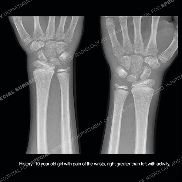 Ultrasound Case 177