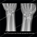 what's the diagnosis thumbnail case 206