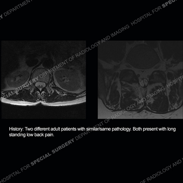 Diagnosis Case 208