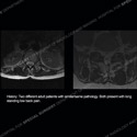 what's the diagnosis thumbnail case 208