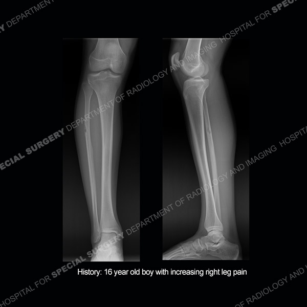 Diagnosis Case 210