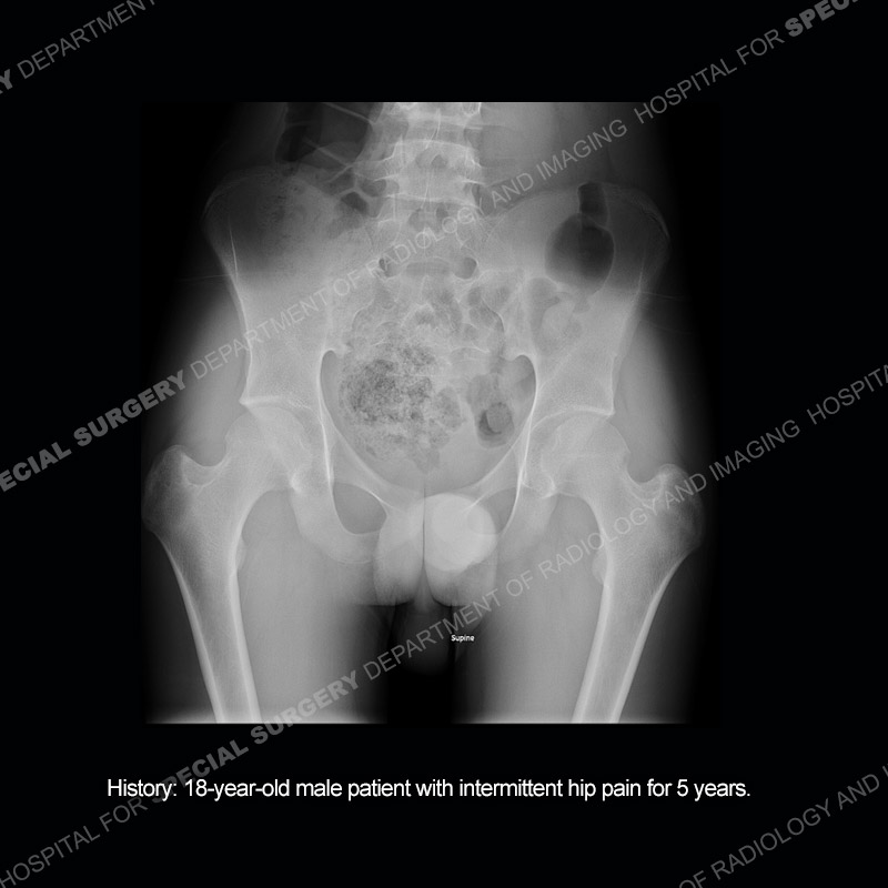 what's the diagnosis thumbnail case 213