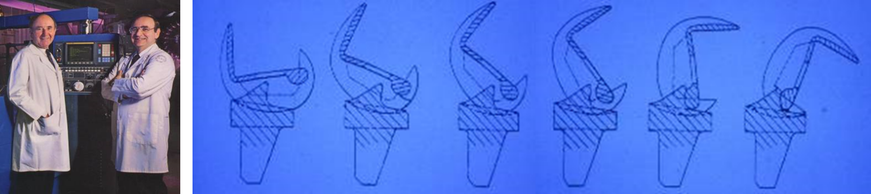 1979 achievement