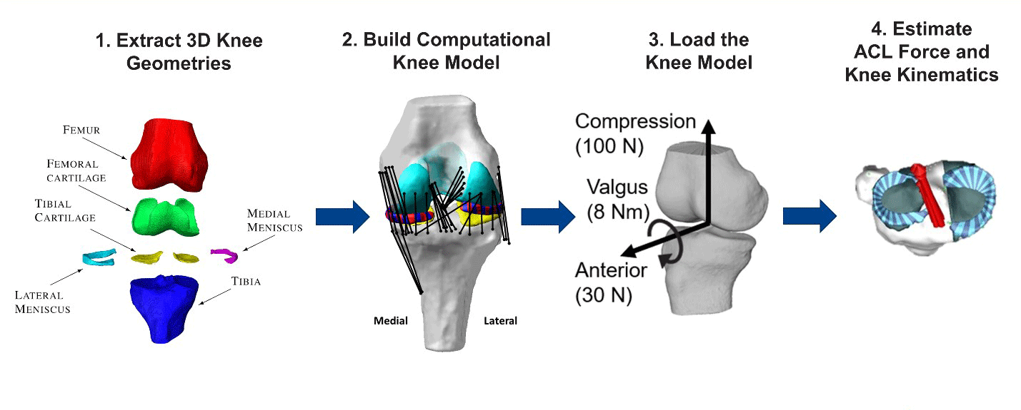 ACL Computation