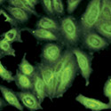 Autoimmunity and Inflmmation Program