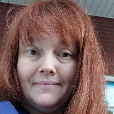 Lisa, HSS Patient