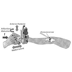 Intraoperative