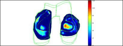 knee gait