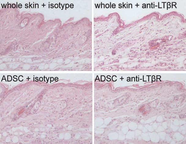 Skin graphic
