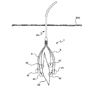 Multi-Catheter-Infusion-System