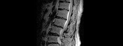 spine image
