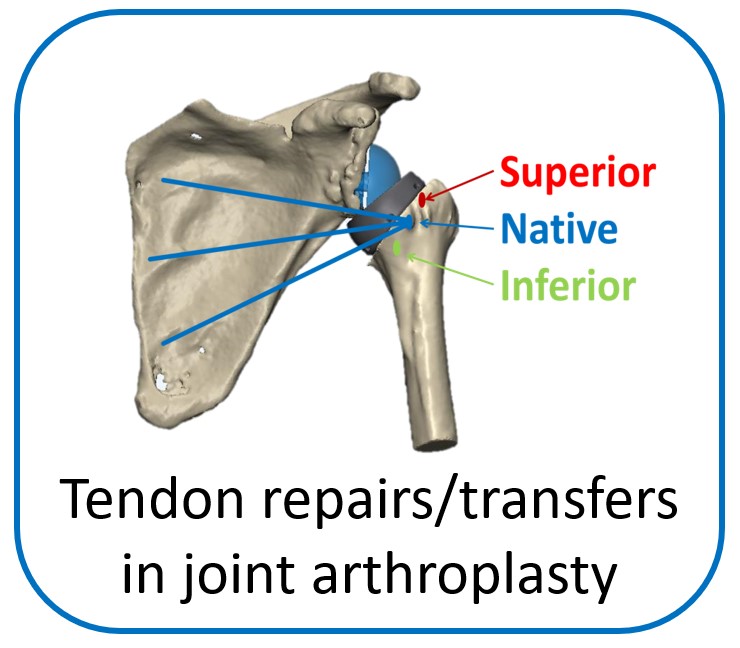 Shoulder research 1