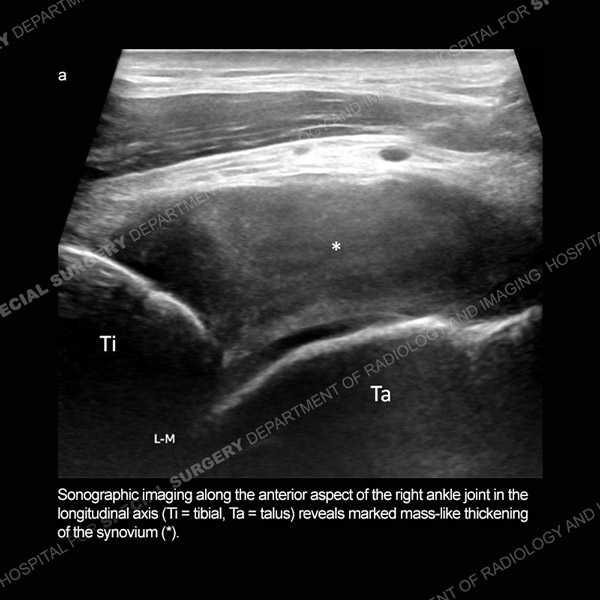 Ultrasound Case 169