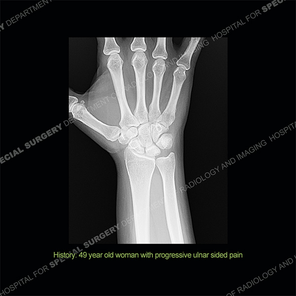 Diagnosis Case 199