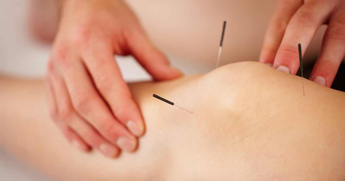 Image - photo for Acupuncture and Surgery: A “New” Tool for Relief